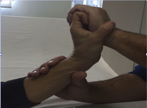 Ejercicios tenodésicos con ayuda de la mano del fisioterapeuta. Extensión de la muñeca con flexión de los dedos. Se realizará también la flexión de la muñeca con la extensión de los dedos. El tacto con ligera presión sobre el dorso de la mano es el estímulo propioceptivo.