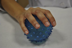 Propiocepción con pelota. Los estímulos propioceptivos serán la presión ejercida sobre la misma y la resistencia que ejerce la pelota sobre la cara palmar de la mano, así como la estabilización del codo. Si colocamos la mano sana sobre el dorso de la afecta, aumenta el control propioceptivo.