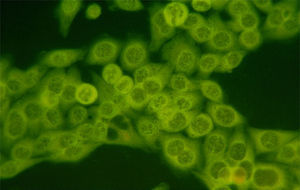 Anticuerpos anticitoplásmicos en células HEp-2 de un paciente con polimiositis, en quien además se detectó la presencia de anticuerpos anti-Jo-1. Se observa fluorescencia difusa en el citoplasma de las células (400×).