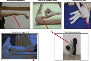 Parámetros a medir en el test de Beighton.