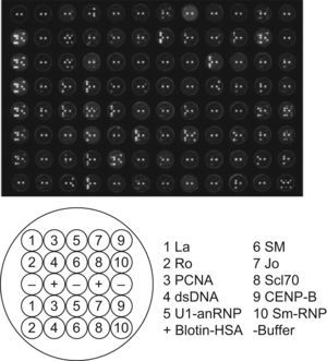 Imagen que muestra una placa del nanoensayo luminométrico múltiple o NALIA (parte superior). En la parte inferior de la imagen se esquematiza un pozo; como se puede ver cada pozo contiene 10 antígenos y 2 controles por duplicado. Los antígenos se muestran en la parte inferior derecha de la imagen. Los controles, localizados en la parte media del pozo son: amortiguador o buffer (control negativo) y albúmina sérica humana unida a biotina (Biotin-HSA, control positivo del sistema). McBride, 2008.