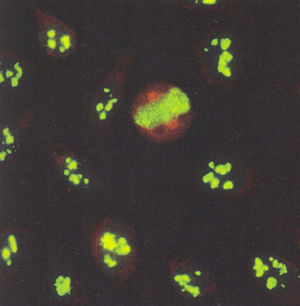 Patrón nucleolar.