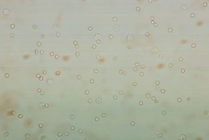 Eritrocitos en SU (400×).