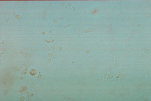 Leucocitos en SU (400×).