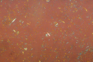 La fotografía muestra cristales de urato monosódico extracelulares con forma de aguja y birrefringencia negativa. La presencia de estos cristales es frecuente en muestras de articulaciones con depósitos tofaceos. Preparación en gota gruesa observada en microscopio de luz polarizada 200×.