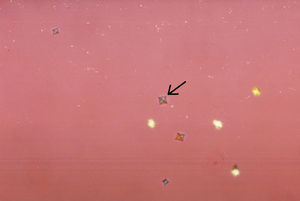 La fotografía muestra cristales de oxalato de calcio, los cuales se observan de forma bipiramidal con birrefringencia positiva. En algunos cristales no se observa birrefringencia. Preparación en gota gruesa observada en microscopio de luz polarizada 400×.