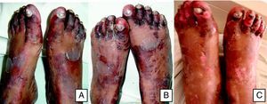 Sequential pictures of the patient