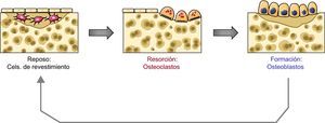 Esquema del remodelado óseo.