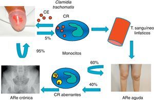 Ciclo de la infección por clamidia. ARe: artritis reactiva; CE: cuerpo elemental; CR: cuerpo reticular.