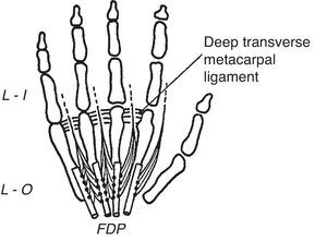 The lumbrical muscles are shown. They are palmar, while the dorsal and the palmar interossei are dorsal, to the transverse metacarpal ligament. From A Companion to Medical Studies, Volume 1, Ed. by Passmore R and Robson JS, 2nd Edition, Oxford, Wiley/Blackwell 1976, p. 23.20, with permission.