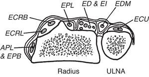 The dorsal fibrous tunnels are shown. An important landmark is the dorsal tubercle of radius (Lister