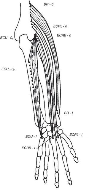 The extensor muscles of the wrist. BR=brachioradialis, ECRL=extensor carpi radialis longus, ECRB=extensor carpi radialis brevis. ECU=extensor carpi ulnaris. O=origin, I=insertion.