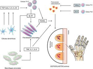 Patogenia de la erosión reumatoide. Abreviaturas: ver glosario de términos en el anexo 1.