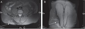 Axial and coronal planes of the patient