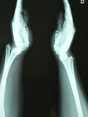 Radiografía lateral de ambos carpos.