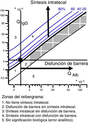 Reibergrama y sus zonas.
