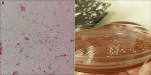 A) Tinción de Gram directa de la muestra. B) Cultivo en agar chocolate.