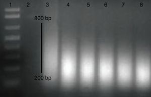 DNA shearing in gel electrophoresis. Lane (1) 100bp ladder, the extracted DNA is sonicated, load in lanes (3–8) and Lane (2): missed.