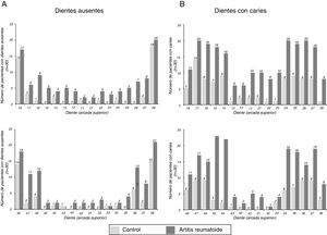 Distribución de ausencias (A) y caries (B) por pieza dental en pacientes con AR y sin AR.