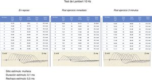 Electrodecremento significativo (> al 10%) de la amplitud al comparar el primer estímulo con los siguientes.