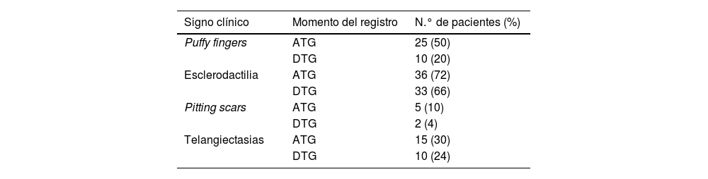 Tablas