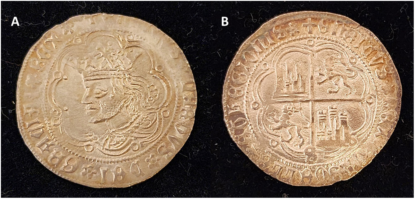 Real 1471 El enigma de la enfermedad de Enrique IV, rey de Castilla: ¿padeció ...