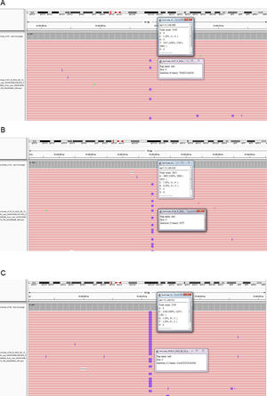 Integrative Genomics Viewer images showing EGFR exon 20 variants identified by NGS in cases 1 (A), 3 (B), and 4 (C) during the second round of the EQA.