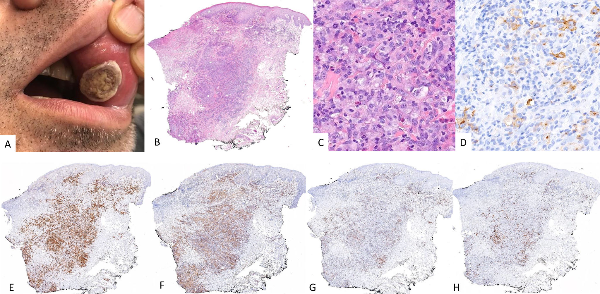 fig0005