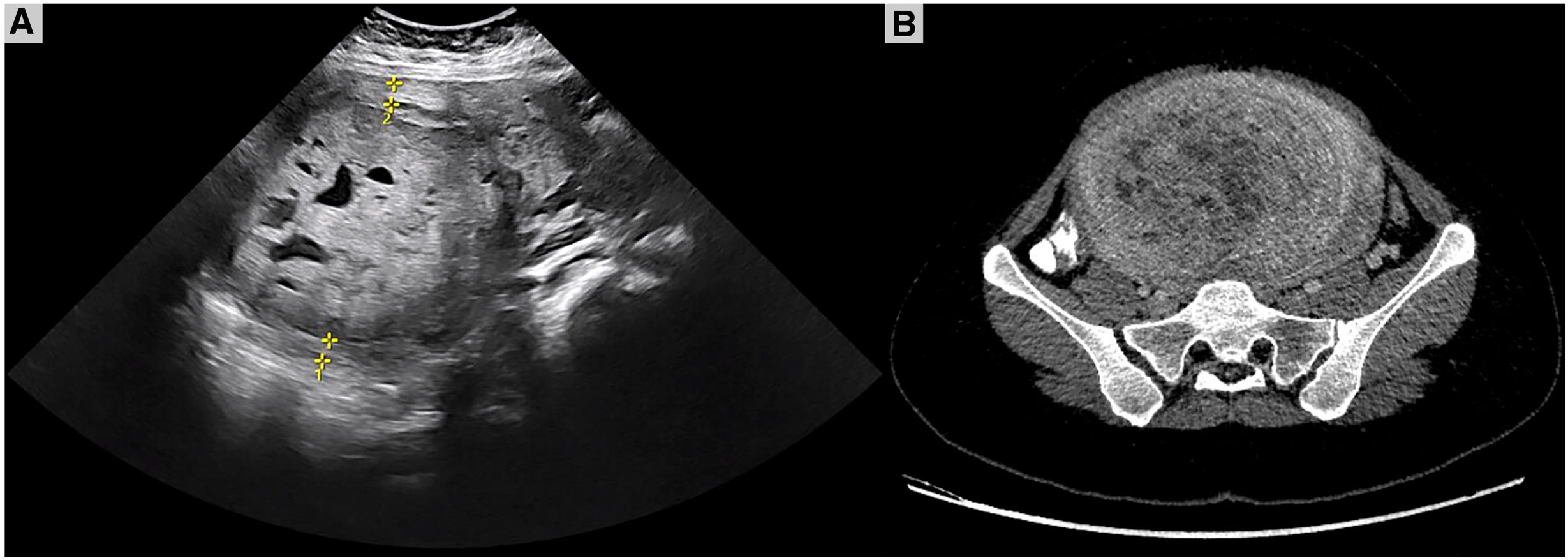 fig0005
