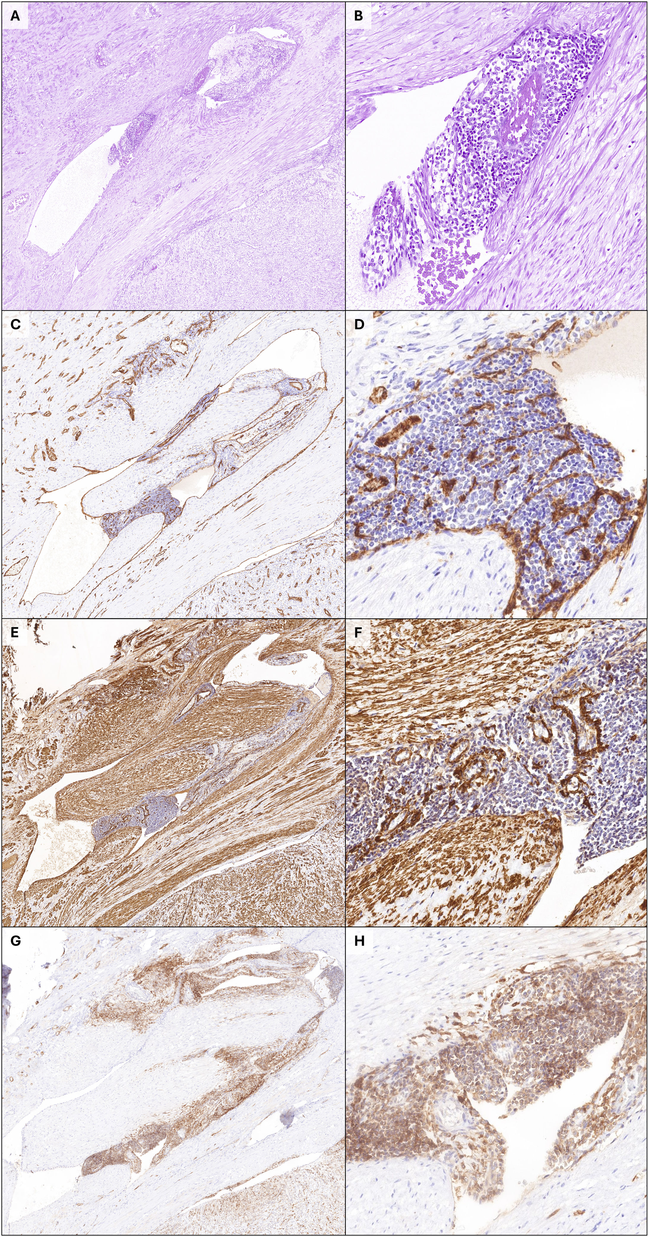 fig0010