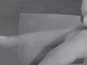 Printing the points on an x-ray used film