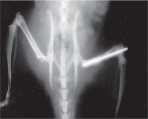 Radiographic image of femur consolidation
