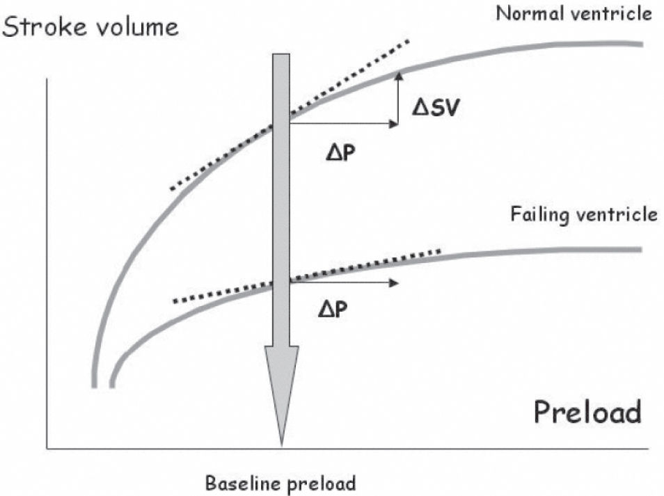 VOLUME MANAGEMENT IN CRITICALLY ILL PATIENTS: NEW INSIGHTS | Clinics