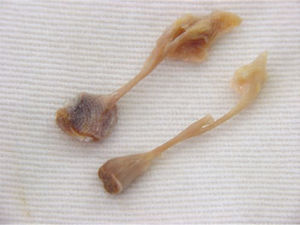 Primary human tendinae chordae of mitral valve after dissected