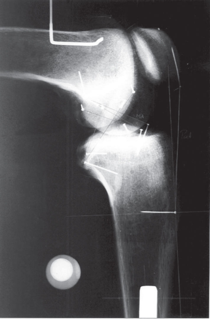 EXPERIMENTAL EVALUATION OF 3-DIMENSIONAL KINEMATIC BEHAVIOR OF THE ...