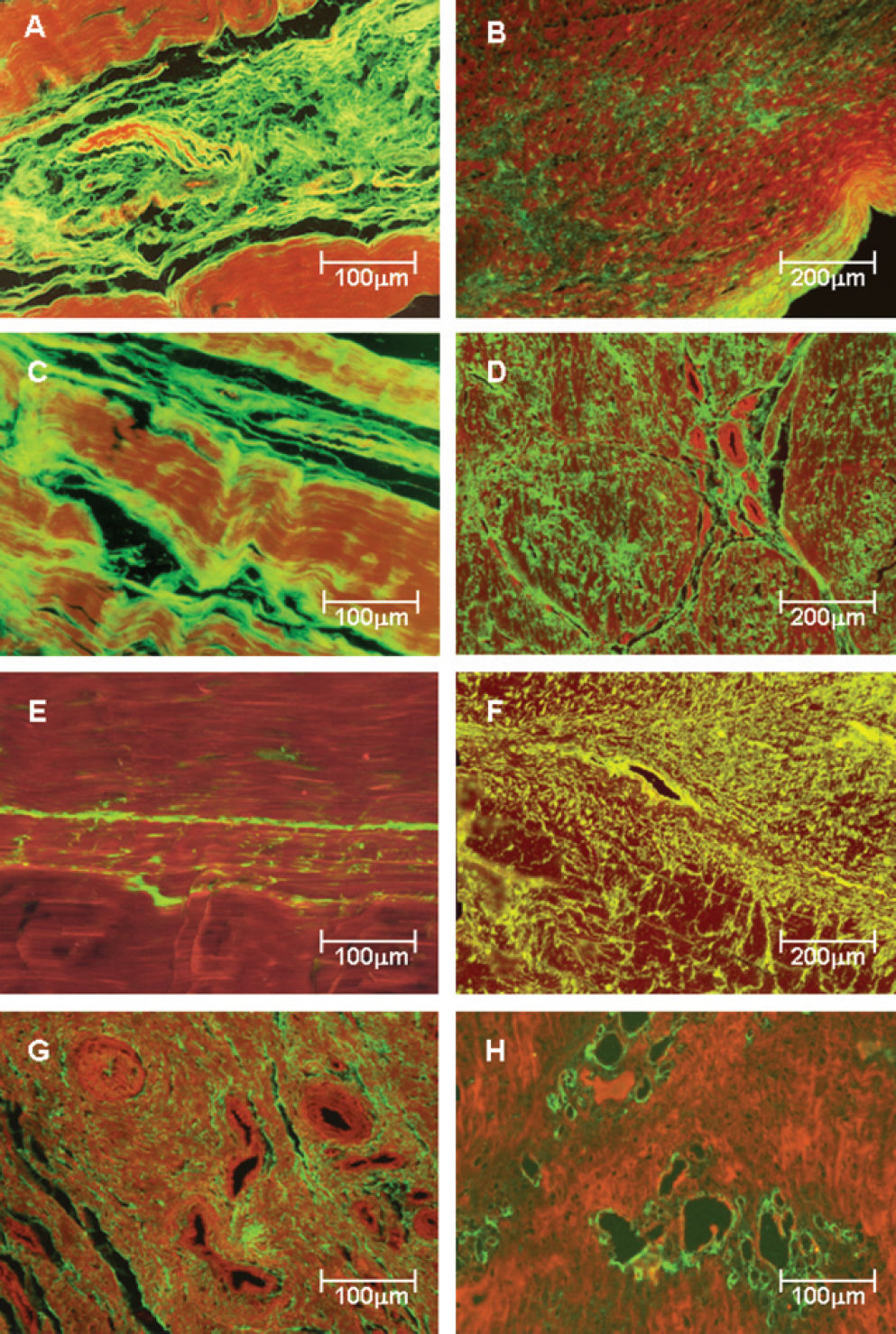 Changes in Histoanatomical Distribution Of Types I, III And V Collagen ...