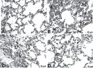 Photomicrographs of HE-stained rat lungs using 400X magnification. (A) C-MV (control, mechanical ventilation) exhibits dilated and congested alveolar septa (arrows); (B) HCl group shows macrophages (arrow) and erythrocytes inside alveolus (asterisk); (C) HCl+PTX group exhibits some inflammatory infiltration, numerous macrophages, neutrophils (arrows) and red blood cells; (D) PTX+HCl group, showing mild alveolar edema and few macrophages in the alveolar lumen (arrow).