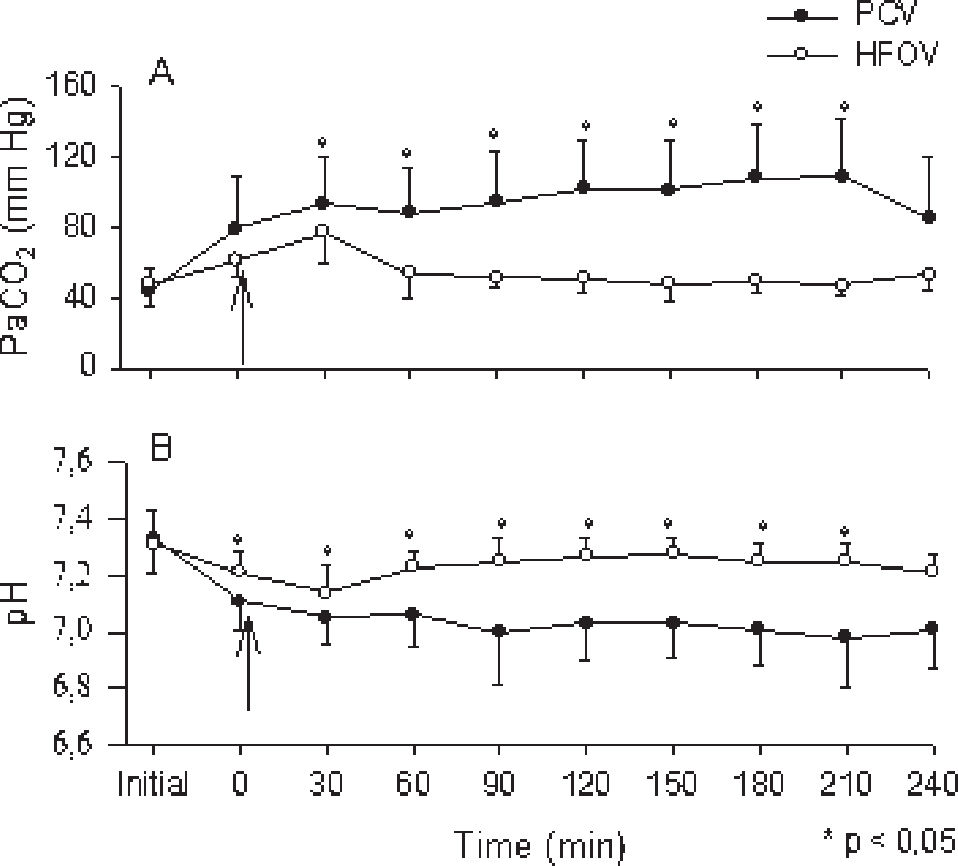 Zero Pcv Utilization of the Lower Inflection Point of the Pressure-Volume Curve ...