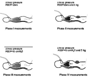 Different phases of the protocol (I, II, III, IV)
