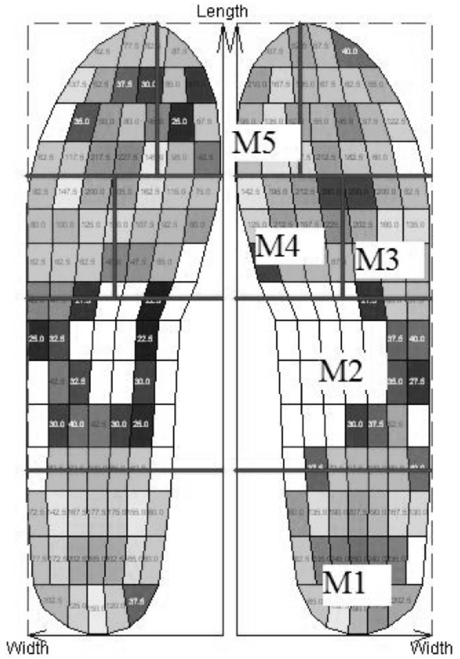 Plantar Ridge Pattern Plantar Pressure Distribution Patterns During Gait in Diabetic ...