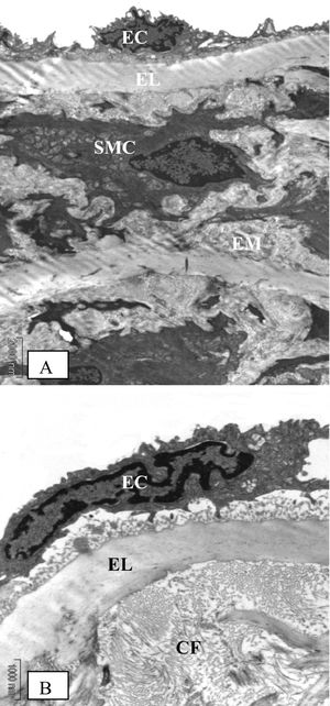 Electron microscopic findings on the aorta of control rats at eight weeks of study. (A) (Original magnification × 4400) The media layer is composed mainly of smooth muscle cells (SMC) with normal appearance, elastic lamina (EL) and extracellular matrix (EM) between the elastic lamina and smooth muscle cells. (B) (Original magnification × 11000) Extracellular matrix contains scattered collagen fibers (CF) and the endothelial cells appear smooth