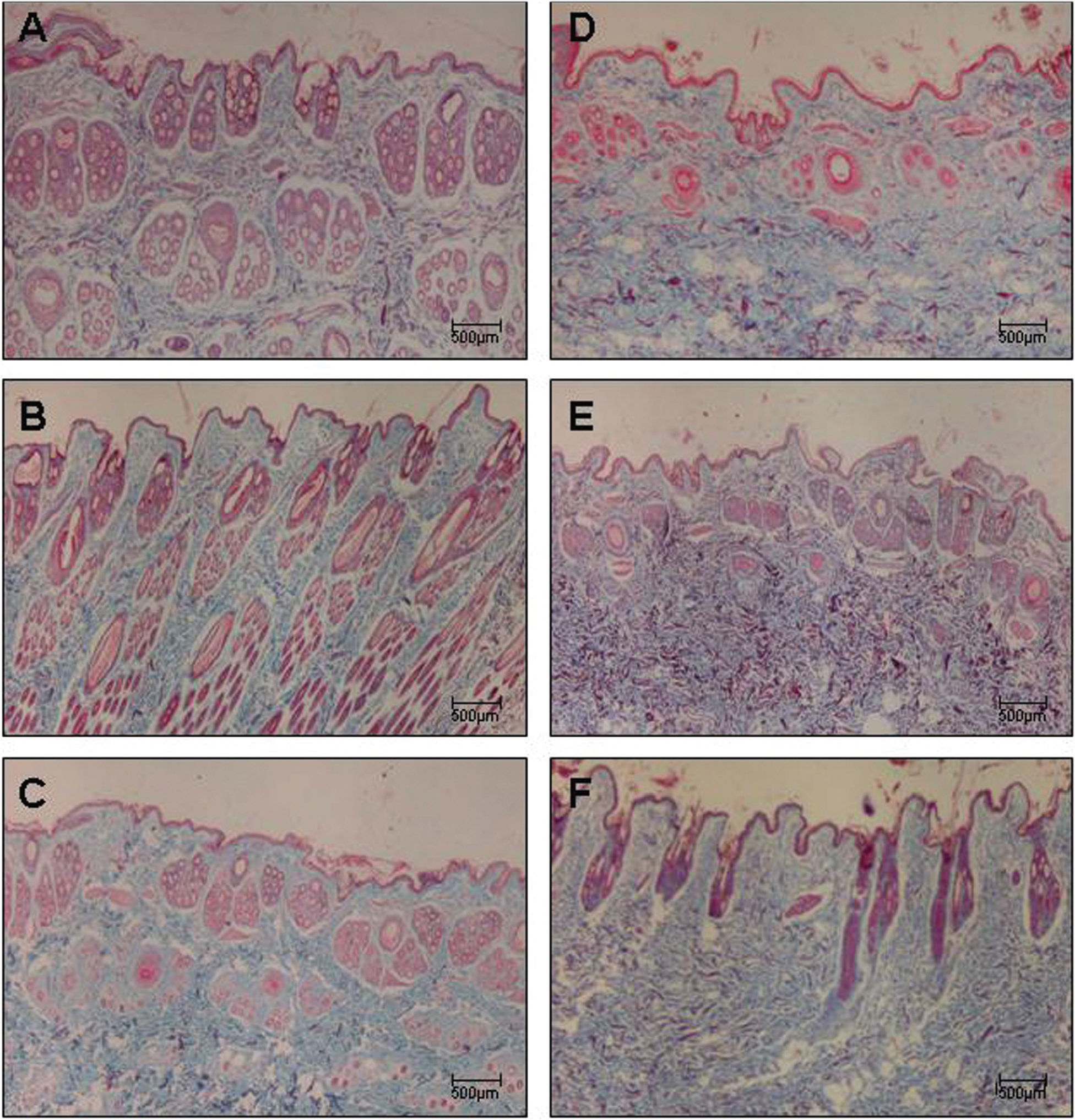 Cutaneous Sample Histomorphometric Analysis of Cutaneous Remodeling in the Early Stage ...