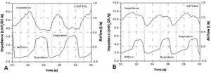 Typical airflow and respiratory impedance analyzed in the control group (A) and asthmatic (B) individuals. Notice the difference in the impedance scales.