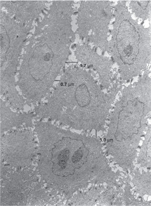 Electron micrograph of the prickle cell layer of the esophageal epithelium from a patient with a normal esophagus prior to HCl infusion (magnification, ×8400)