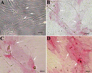 CQ enhances differentiation of bone marrow mesenchymal stem cells (MSCs) into osteoblasts: MSCs were grown in basal media and supplemented with 100, 200 or 300 μg/mL CQ plant extract (B, C and D, respectively) and stained for alkaline phosphatase (ALP). Note that MSCs grown in the control media are negative for ALP (A), cells grown in the basal media supplemented with 100, 200 μg/mL CQ (B,C) are weakly positive for ALP, and cells supplemented with 300 μg/mL CQ (D) are strongly positive for ALP, suggesting differentiation into osteoblasts. Arrows indicate undifferentiated MSCs in A and differentiating MSCs in B, C and D. Scale bar=25 μm. Magnification=20×