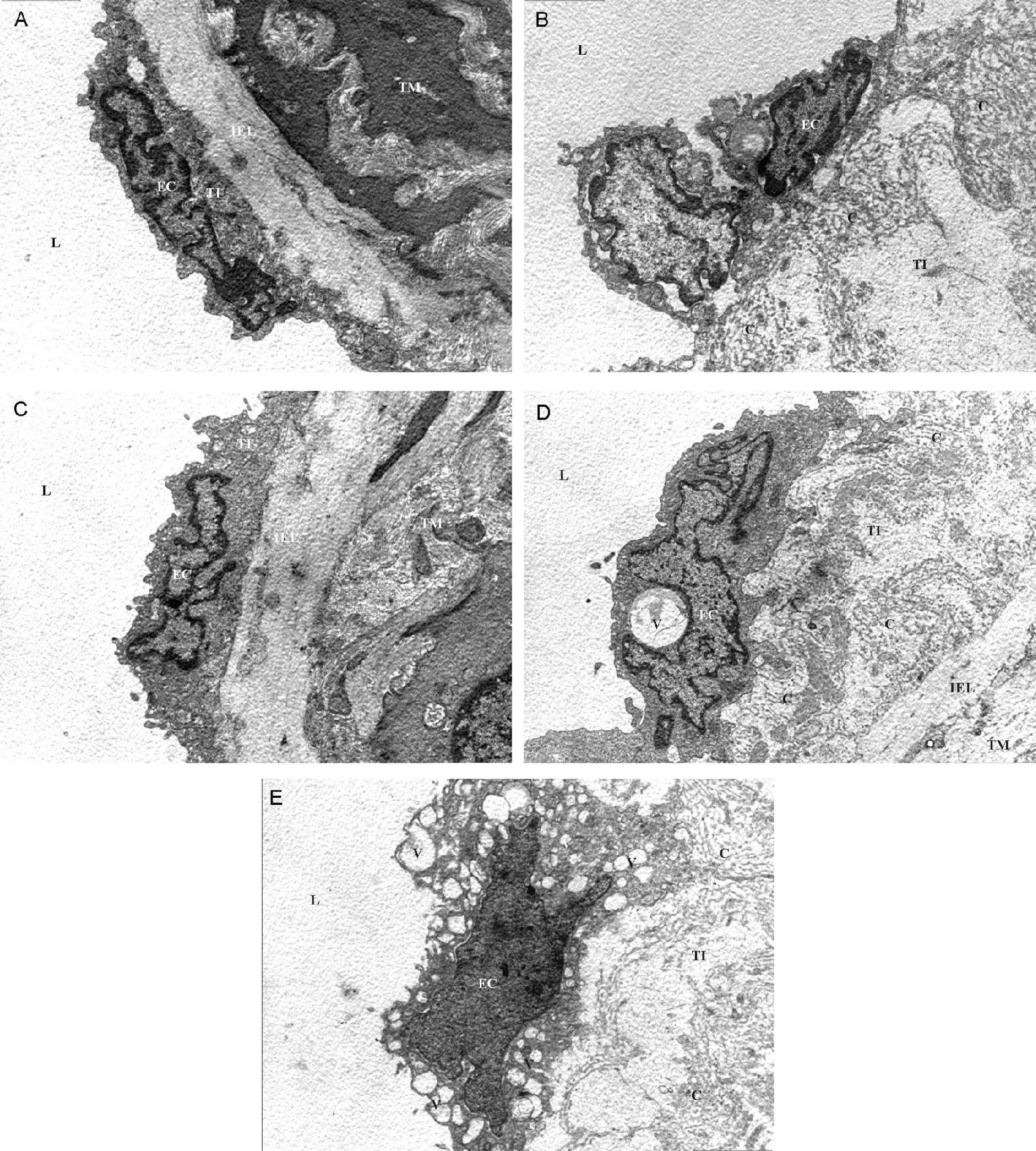 Fresh Soy Oil Protects Against Vascular Changes in an Estrogen