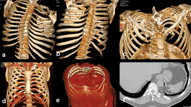 Three-dimensional scanning with dual-source computed tomography in ...