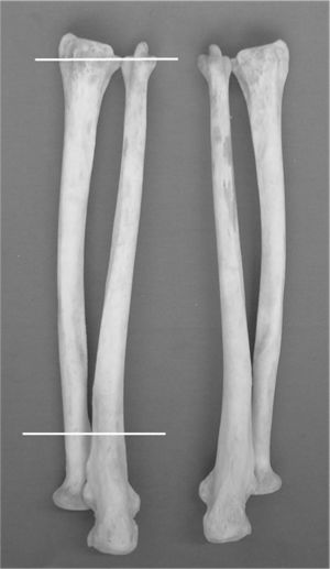 Well-preserved dry forearm bones from a cadaver. The lines mark the proximal and distal levels corresponding to the sections evaluated by computed tomography.