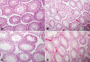 (a) Normal morphological appearance seminiferous tubule in contralateral testis of group 1 (H&E, 200×). (b) Degeneration, desquamation and disorganization in germinal cell along with interstitial oedema, capillary congestion and hemorrhage in group 2 (H&E, 200×). (c) Normal morphological appearance seminiferous tubule in group 3 (H&E, 200×). (d) Degeneration, desquamation, disorganization and reduction in germinal cell along with interstitial oedema, capillary congestion and hemorrhage in group 4 (H&E, 200×).