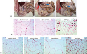 (a) An adrenalectomized rat treated with dexamethasone (ADR+Dexa) and a rat from the sham-operated group had more visceral fat deposition (perirenal fat—red arrows; mesenteric fat—blue arrows) compared with the rat from the baseline control group. (b) The number of adipocytes per slide (H&E staining) was greater in the adrenalectomized rats treated with dexamethasone (ADR+Dexa), but the diameters of these cells were smaller than those seen in rats from the sham-operated and baseline control groups. The circles show hyperplasia of adipocytes, and the arrows show blood vessels. Magnification X 20. (c) Immunoreactive staining of 11β-HSD1 in adrenalectomized rats treated with dexamethasone (ADR+Dexa) showed stronger immunoreactive staining compared with that of the baseline control and sham-operated rats. Magnification X 20.